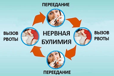 Лечение булимии в Комсомольском